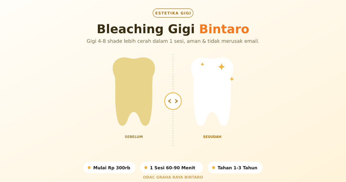 Bleaching Gigi Bintaro di ODAC Corp: Prosedur & Hasil