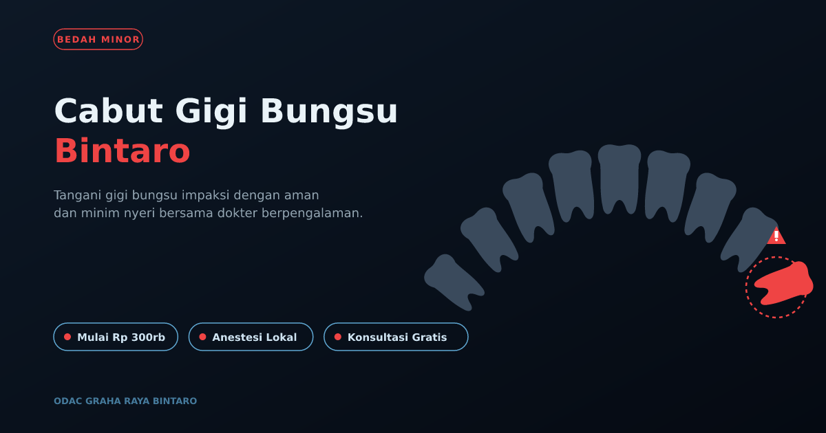 Cabut Gigi Bungsu Bintaro – ODAC Corp: Prosedur & Biaya