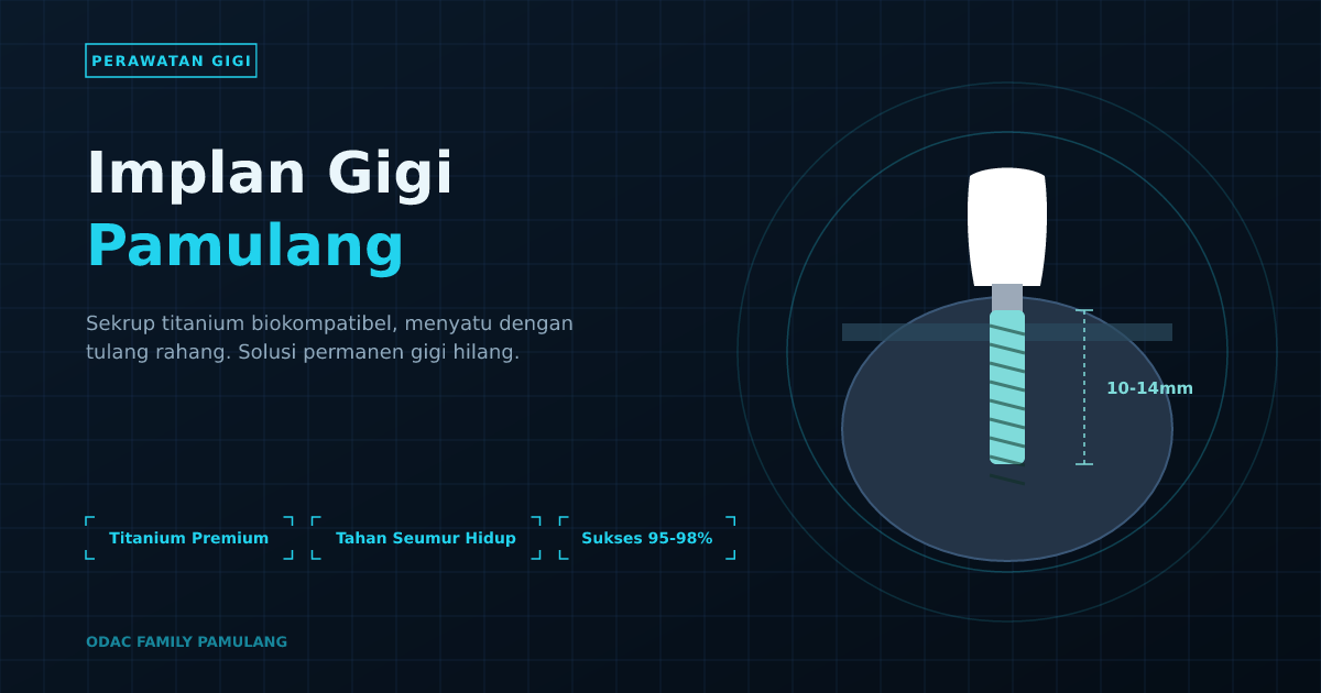 Implan Gigi Pamulang: Solusi Permanen di ODAC Family
